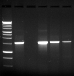 LOEWE Molecular Diagnostics - DNA PCR κιτ